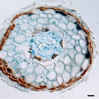 Micronaturale: le micorrize