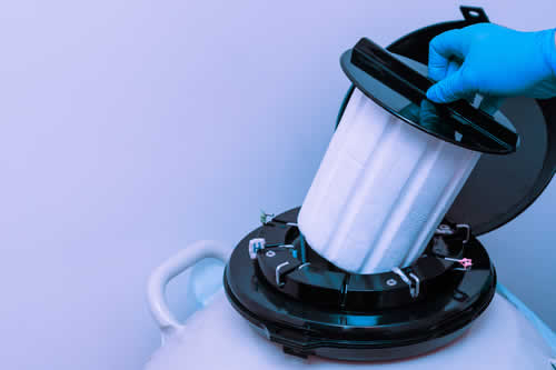 Micronaturale: metodi per preservare le colture in&nbsp;microbiologia