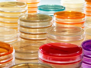 Micronaturale: quali sono i componenti di crescita dei microrganismi usati a livello&nbsp;industriale