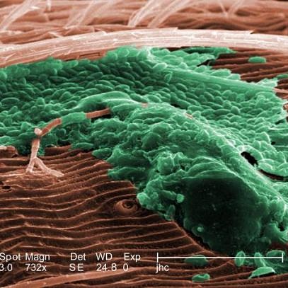 Cosa sono i biofilm e i feltri&nbsp;microbici?