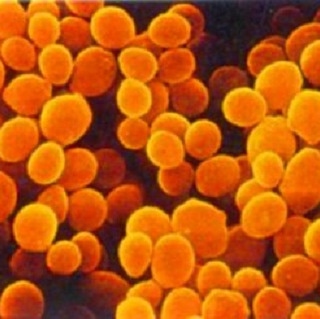 La morfologia batterica