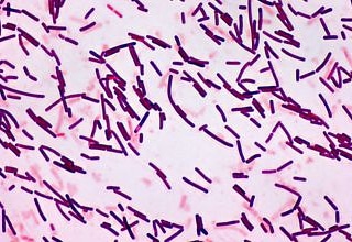 Microrganismi per la prevenzione delle malattie nelle colture fuori&nbsp;suolo.