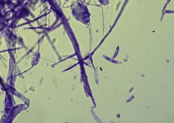 La risposta dei microrganismi alle variazioni ambientali e alla disponibilità di&nbsp;nutrienti